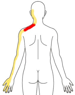 2026-0313 朝の痛み