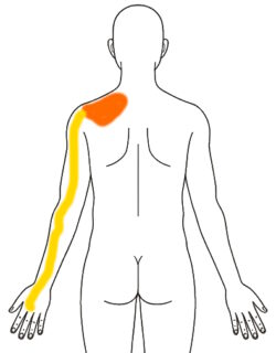 2026-0310 朝の痛み