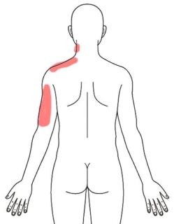 首・肩が痛い、手がしびれる症状のまとめ