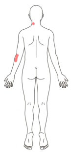 2026-0305 PM キーボード操作のせいか痛くなる所