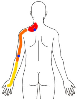 2026-0311 朝の痛み