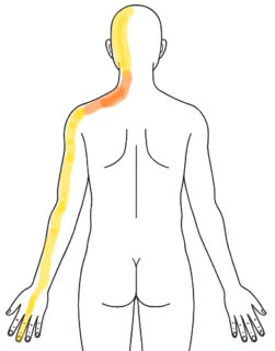2026-0314 朝の痛み